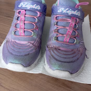 Az Kullanılan Skechers Ayakkabıda Erken Deformasyon Ve Sonuçsuz Destek