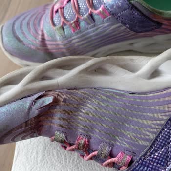 Az Kullanılan Skechers Ayakkabıda Erken Deformasyon Ve Sonuçsuz Destek