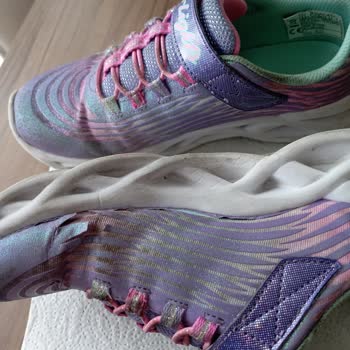 Az Kullanılan Skechers Ayakkabıda Erken Deformasyon Ve Sonuçsuz Destek