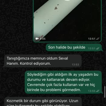 Dyson Airwrap Gövdesinde Kabarcık Ve Soyulma Sorunu, Servisten Çözüm Alamama