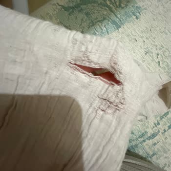 İlk Yıkamada Yırtılan Tunik Ve Kalitesizlik
