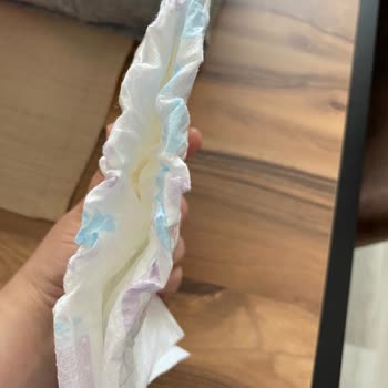 Molfix Bezlerde İncelme Ve Sızdırma Sorunu Yaşadık