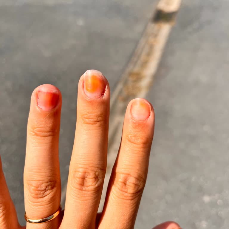 Flormar Oje Tırnaklarda Kalıcı Lekeler Bıraktı