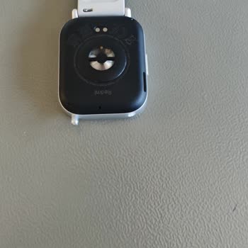 Xiaomi Refused Warranty Repair for My Redmi Watch 5 Active