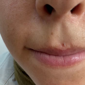 Başarısız Tedavi Ve Memnuniyetsiz Müşteri Deneyimi