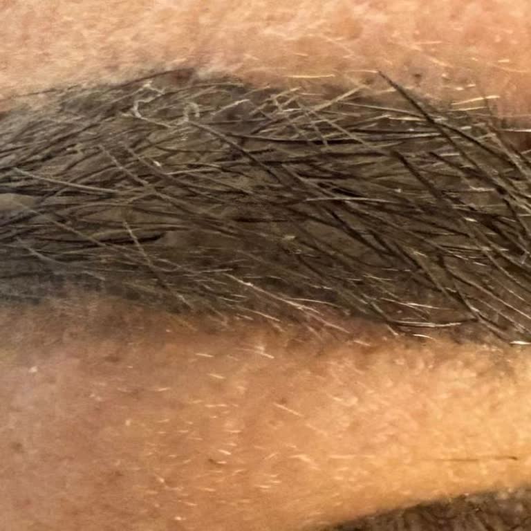 Kaş Tasarımında Hatalı İşlem Ve Mağduriyet: Ücret İadesi Ve İlgi Eksikliği