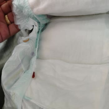 Bebek Bezinde Canlı Kurt Çıkması: Sağlık Ve Güvenlik Endişesi