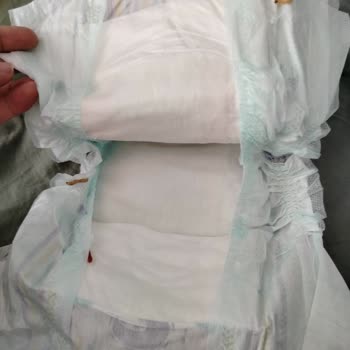 Bebek Bezinde Canlı Kurt Çıkması: Sağlık Ve Güvenlik Endişesi