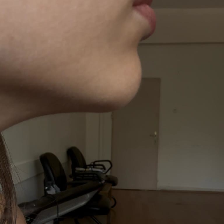 Dolgu Sonrası Yüzümde Kalıcı Değişiklik Ve Yetersiz Bilgilendirme