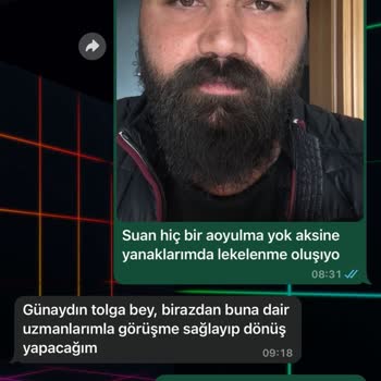 Cilt Lekelerim İçin Vaat Edilen Sonuçlar Gerçekleşmedi, İlgisiz Ve Kaba Yaklaşım