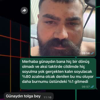 Cilt Lekelerim İçin Vaat Edilen Sonuçlar Gerçekleşmedi, İlgisiz Ve Kaba Yaklaşım