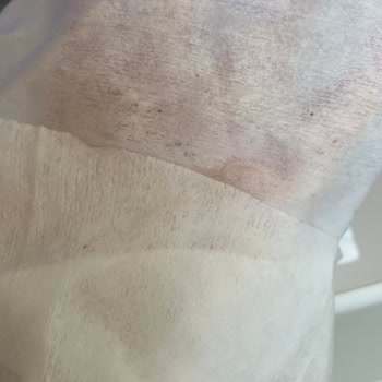 Sleepy Yenidoğan Islak Mendilde Küf Şoku: Bebeğim İçin Güvenli Değil!