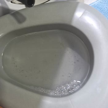 Çamaşır Makinesinden Sürekli Koku Ve Yetersiz Temizlik Sorunu