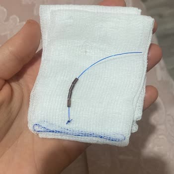 Spiral Düşmesi Sonrası Mağduriyetim Giderilmiyor