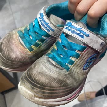 2 Ayda Kullanılmaz Hale Gelen Skechers Ayakkabılar İçin Talebim Reddedildi