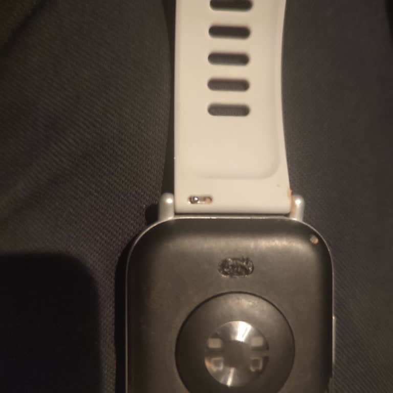 Redmi Watch 5 Active Şarj Sorunu Ve İlgisiz Servis Deneyimi