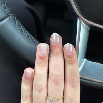 Hijyen Eksikliği Ve Sağlıksız Uygulamalar Endişe Veriyor