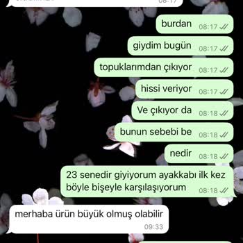 Aldığım Ayakkabı Topuğumdan Çıkıyor, İade Kabul Edilmiyor