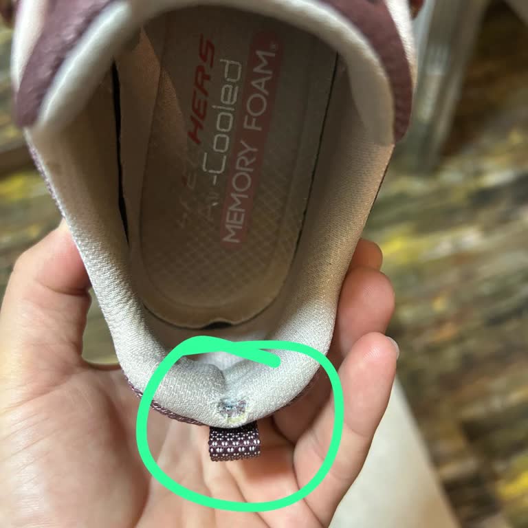 Skechers Ayakkabı İnceleme Süreci Uzadı Çözüm Bekliyorum