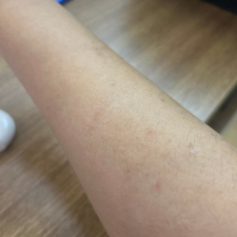 Güzellik Merkezinde Cihaz Sorunu Ve Fatura Eksikliği