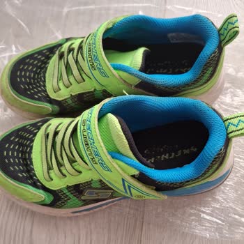 Skechers Ayakkabıda Hızlı Deformasyon Ve Mağduriyet