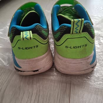 Skechers Ayakkabıda Hızlı Deformasyon Ve Mağduriyet