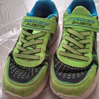 Skechers Ayakkabıda Hızlı Deformasyon Ve Mağduriyet