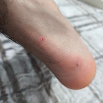 FLO Mağazasından Aldığım Ayakkabıda Garanti Sorunu Yaşadım