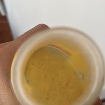 Bozulmuş Kefir Ürünü Sağlık Riski Yarattı