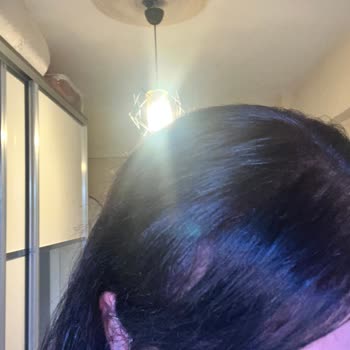 Açık Kızıl Saçım Koyu Kahveye Döndü, Zararım Karşılanmalı!