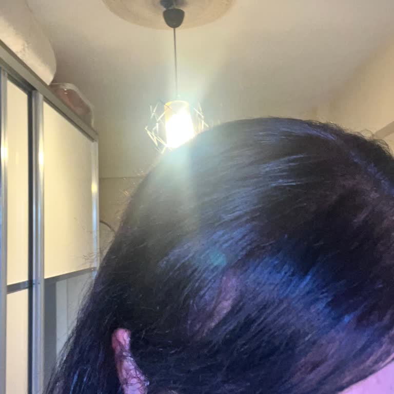 Açık Kızıl Saçım Koyu Kahveye Döndü, Zararım Karşılanmalı!