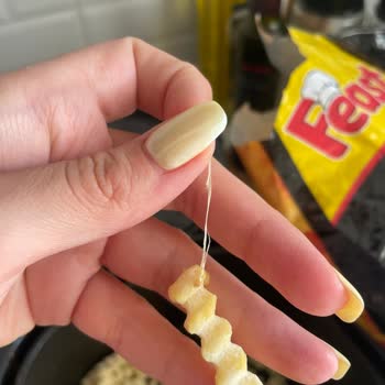 Dondurulmuş Patateste Yabancı Cisim Şoku