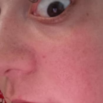 Med & Care Güzellik Salonu Bir Demet İpek Kirpiği 4 Kirpiğin Üzerine Yapıştırmışlardı