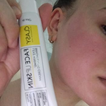 Kullandığım Yüz Kremi Cildimde Yanma Ve Şişmeye Sebep Oldu