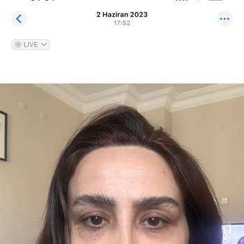 Gözaltı Tedavisi Sonuçsuz Kaldı, İlgisiz Hizmet