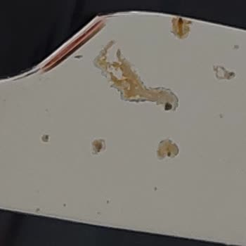 Jumbo Çelik Bıçak Setinde Pas Sorunu Ve Güven Kaybı