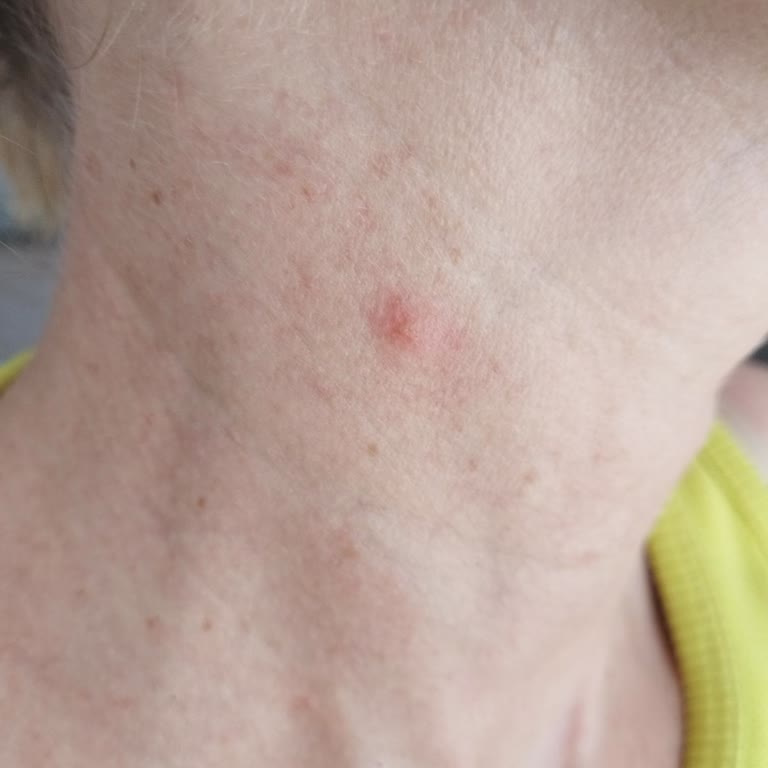 Cilt Bariyerimi Bozan Güneş Kremi Ve İlgisiz Marka