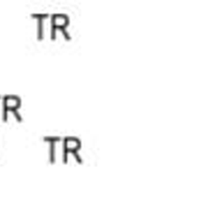 Onaysız Kart Aidatı Kesintisiyle Mağduriyet Yaşadım