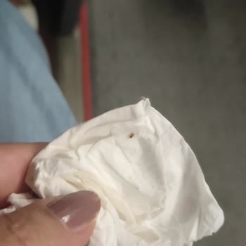 Şanlıurfa Cesur Turizm Otobüste Böcek İstilası Ve Hijyen Sorunu Yaşadım