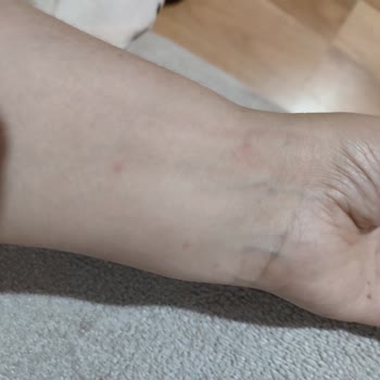 Şanlıurfa Cesur Turizm Otobüste Böcek İstilası Ve Hijyen Sorunu Yaşadım