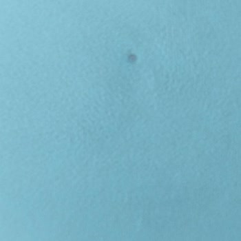 Eksik Ve Kusurlu Koltuk Sonrası İlgisizlik Mağduriyeti