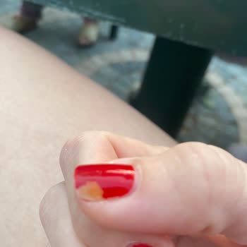 Flormar Jelly Look Oje Tırnakta Kalıcı Turunculuk Ve Sağlık Riski