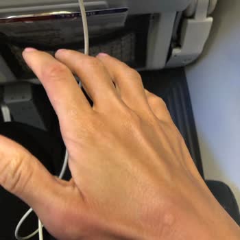 Uçakta Kirli Koltuk Ve Böcek Sorunu Yaşadım