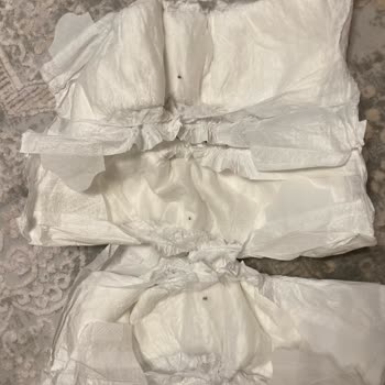 Bebek Bezinde Güvenlik Endişesi: Sert Cisimle Karşılaşma