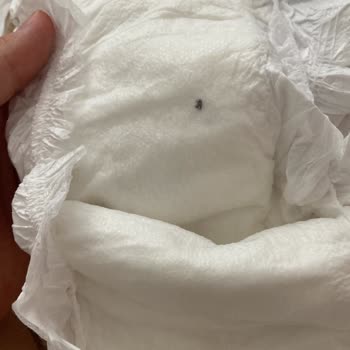 Bebek Bezinde Güvenlik Endişesi: Sert Cisimle Karşılaşma