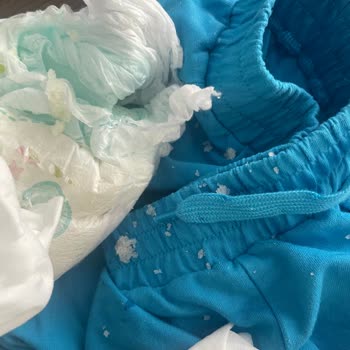 Prima Külot Bezde Tekrar Eden Sızıntı Sorunu Mağduriyet Yaşattı