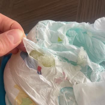 Prima Külot Bezde Tekrar Eden Sızıntı Sorunu Mağduriyet Yaşattı