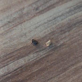 Dominos Pizzadan Çıkan Sert Cisim Dişimi Zedeledi