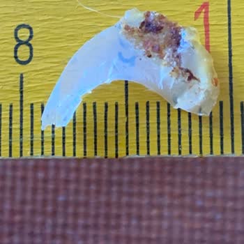 Siparişimde Cam Parçası Çıktı, Firma Duyarsız Kaldı