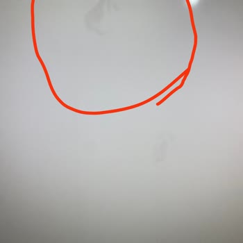 Televizyon Ekranında Yaygın Leke Sorunu Ve Yetersiz Çözüm